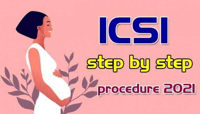 icsi-procedure step by step