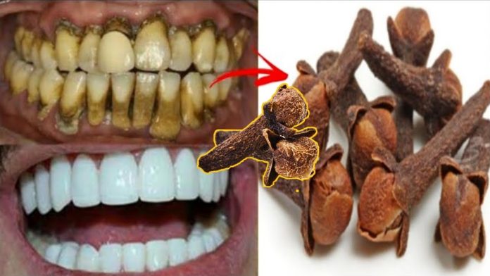How to make teeth white naturally from yellow in telugu 2021